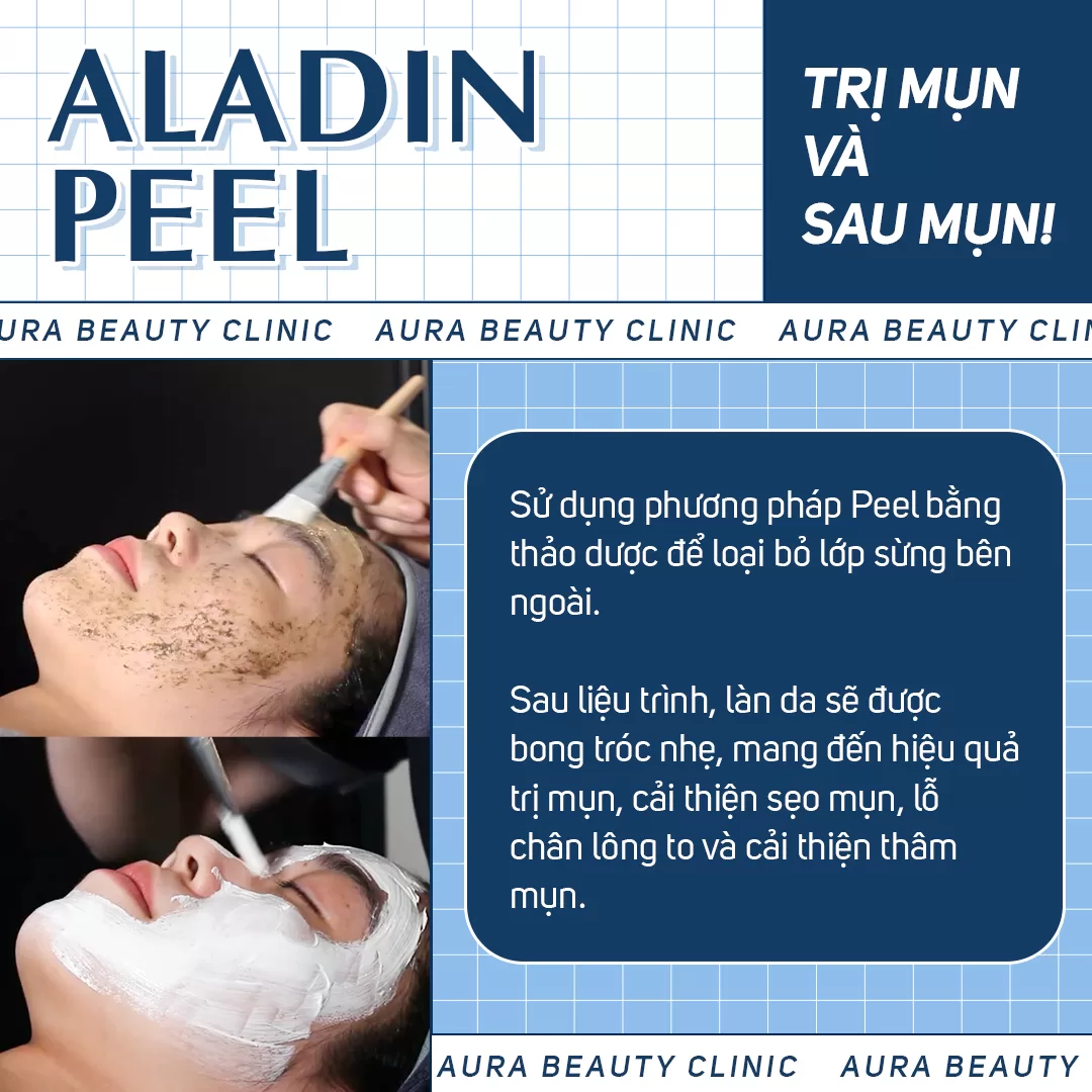 chăm sóc da - aladin peel