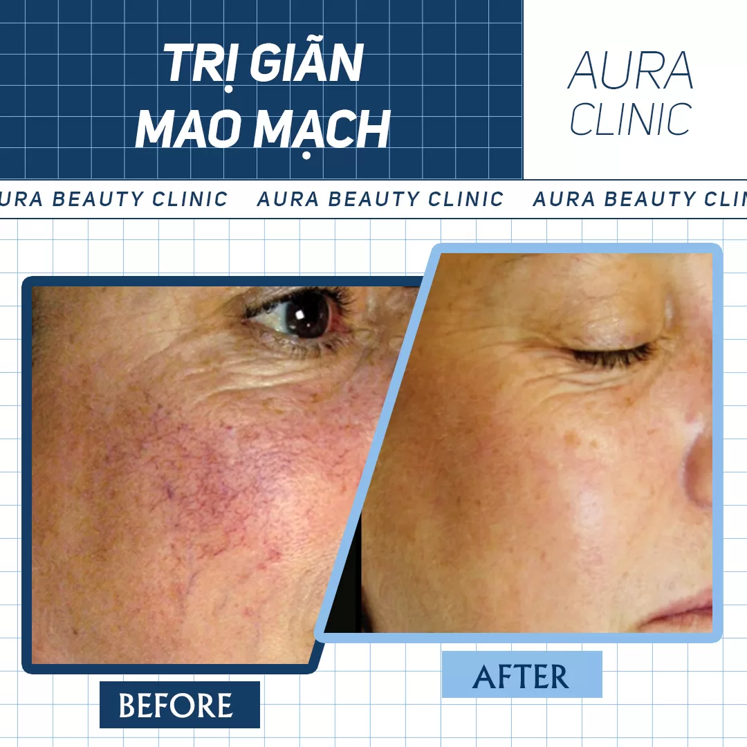 Hình ảnh thực tế 2 (5)