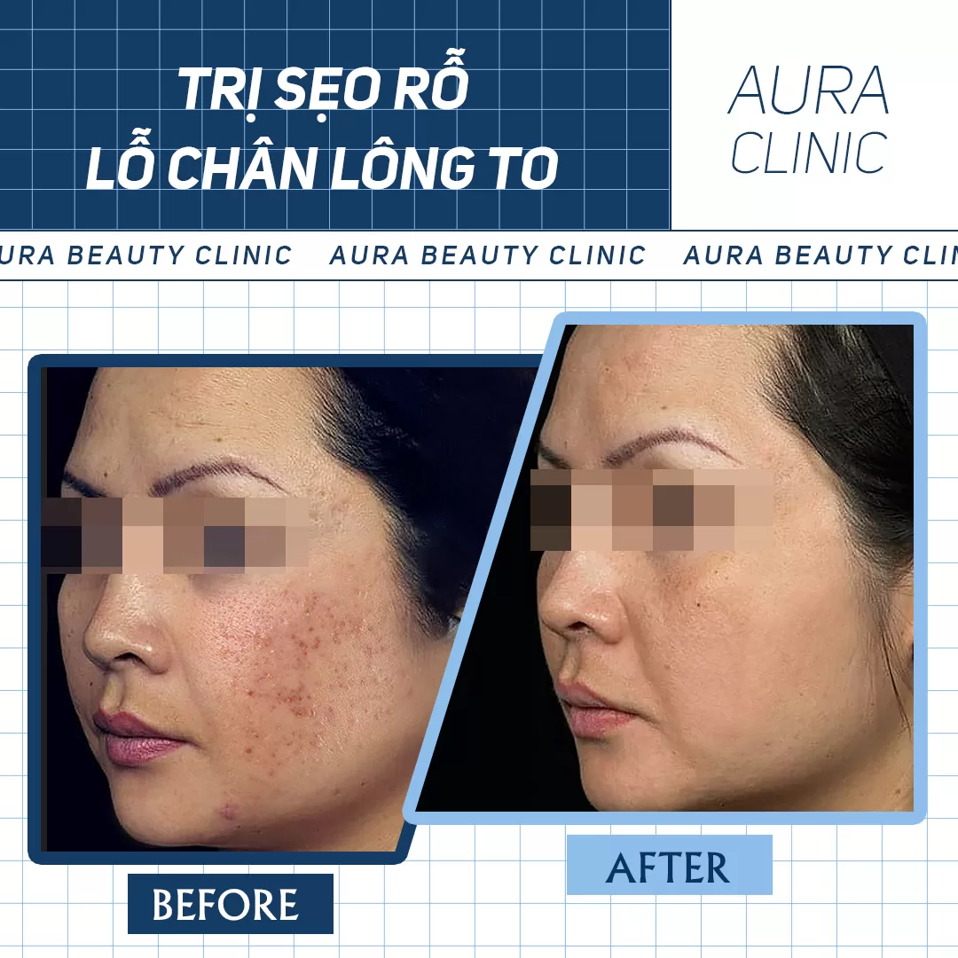 Hình ảnh thực tế 2 (6)