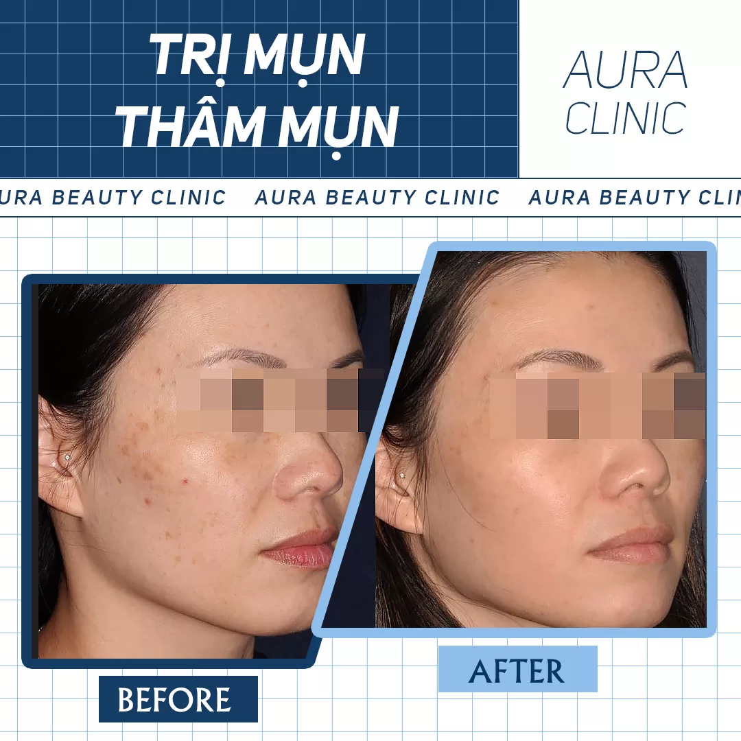 Hình ảnh thực tế 2 (7)