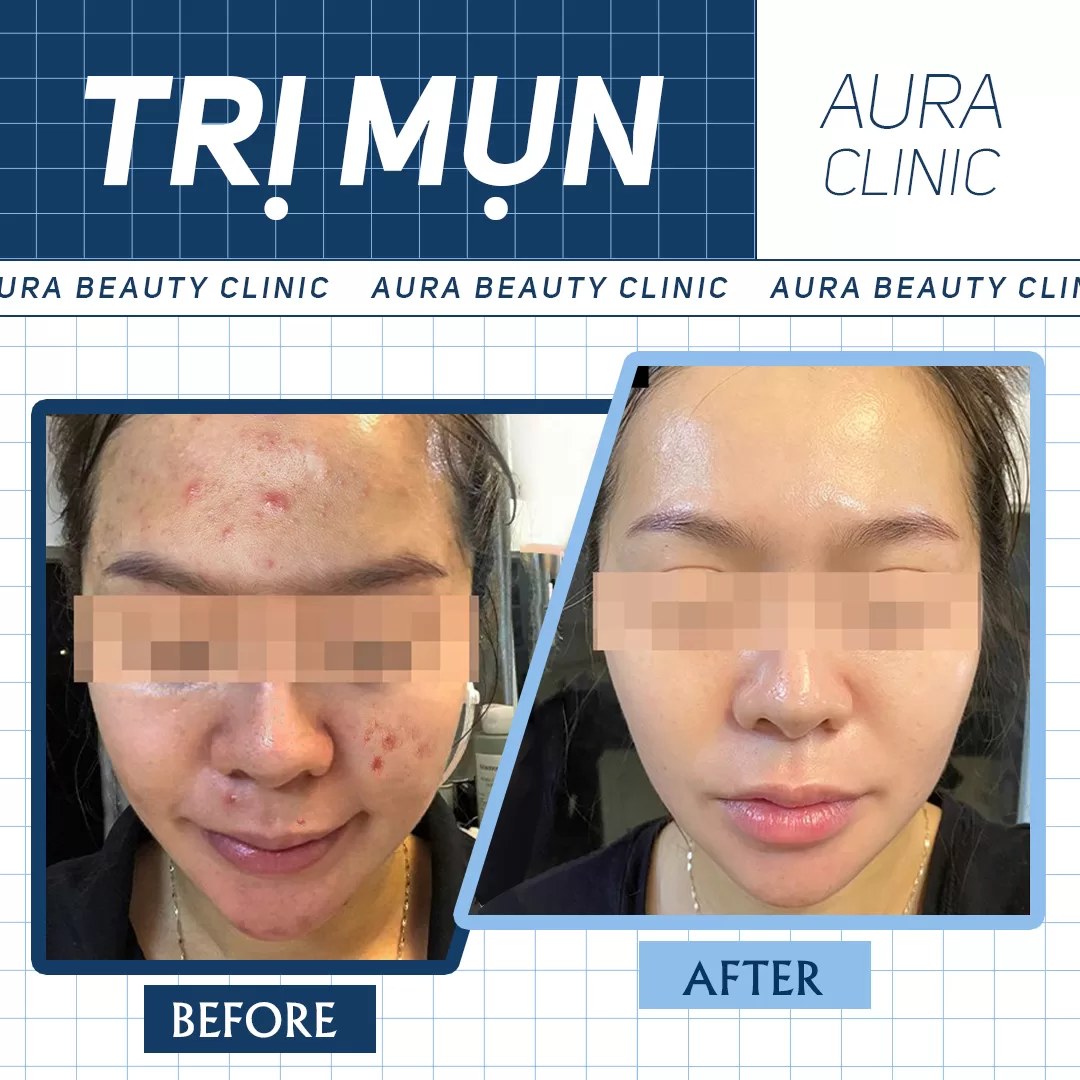 Hình ảnh thực tế 2 (8)